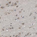 Seryl-tRNA synthetase Antibody in Immunohistochemistry (Paraffin) (IHC (P))