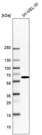 Seryl-tRNA synthetase Antibody in Western Blot (WB)