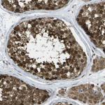 USP30 Polyclonal Antibody