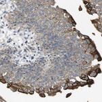 Cytokeratin 23 Polyclonal Antibody