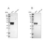 Cytokeratin 23 Antibody in Western Blot (WB)