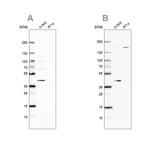 GALK1 Antibody in Western Blot (WB)