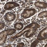 DAP5 Polyclonal Antibody