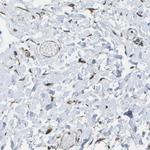 LEPRE1 Polyclonal Antibody