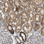 RAB21 Antibody in Immunohistochemistry (Paraffin) (IHC (P))