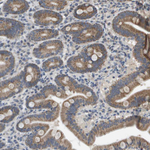 RAB21 Polyclonal Antibody