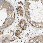 RAB21 Antibody in Immunohistochemistry (Paraffin) (IHC (P))