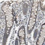 RAB21 Antibody in Immunohistochemistry (IHC)