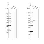 P4HA2 Antibody in Western Blot (WB)