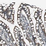 UTS2 Polyclonal Antibody