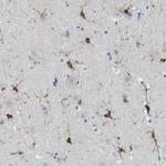 RIAM Antibody in Immunohistochemistry (Paraffin) (IHC (P))