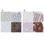 RIAM Antibody in Immunohistochemistry (Paraffin) (IHC (P))