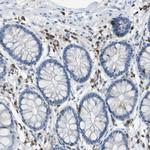 RIAM Antibody in Immunohistochemistry (Paraffin) (IHC (P))