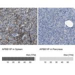RIAM Antibody in Immunohistochemistry (IHC)