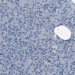 RIAM Antibody in Immunohistochemistry (IHC)
