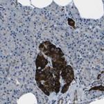 PDLIM1 Antibody in Immunohistochemistry (Paraffin) (IHC (P))