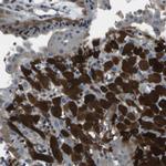 PDLIM1 Antibody in Immunohistochemistry (Paraffin) (IHC (P))