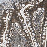 PDLIM1 Polyclonal Antibody