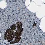 PDLIM1 Antibody in Immunohistochemistry (IHC)
