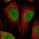 MRG Polyclonal Antibody