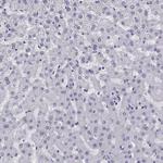 MRG Antibody in Immunohistochemistry (Paraffin) (IHC (P))