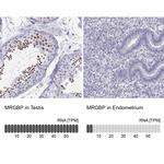 MRG Antibody in Immunohistochemistry (IHC)