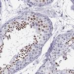 MRG Antibody in Immunohistochemistry (IHC)