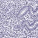 MRG Antibody in Immunohistochemistry (IHC)