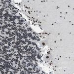 GATAD2B Antibody in Immunohistochemistry (Paraffin) (IHC (P))