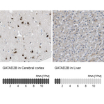 GATAD2B Antibody in Immunohistochemistry (Paraffin) (IHC (P))