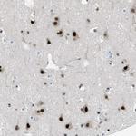 GATAD2B Antibody in Immunohistochemistry (Paraffin) (IHC (P))