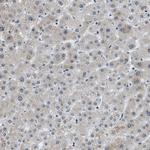 GATAD2B Antibody in Immunohistochemistry (Paraffin) (IHC (P))