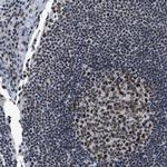 GATAD2B Antibody in Immunohistochemistry (Paraffin) (IHC (P))