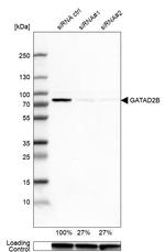 GATAD2B Antibody