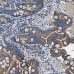 CLCA4 Antibody in Immunohistochemistry (Paraffin) (IHC (P))