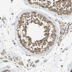 DNAJB11 Polyclonal Antibody