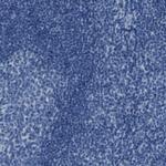 CDHR2 Antibody in Immunohistochemistry (Paraffin) (IHC (P))