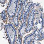 CDHR2 Antibody in Immunohistochemistry (IHC)