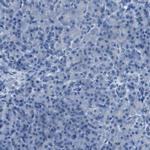CDHR2 Antibody in Immunohistochemistry (IHC)