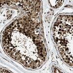 CCDC104 Polyclonal Antibody