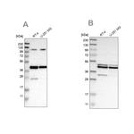 CCDC104 Antibody in Western Blot (WB)