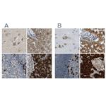 TRAP alpha Polyclonal Antibody