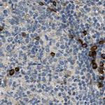 TRAP alpha Antibody in Immunohistochemistry (IHC)