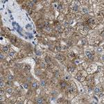 TRAP alpha Antibody in Immunohistochemistry (IHC)
