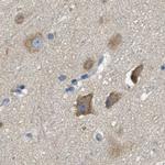 TRAP alpha Antibody in Immunohistochemistry (IHC)