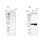 TRAP alpha Antibody in Western Blot (WB)