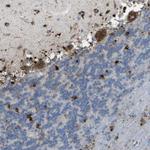 PRCP Polyclonal Antibody