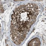 Vezatin Polyclonal Antibody