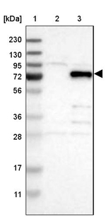 Vezatin Antibody in Western Blot (WB)