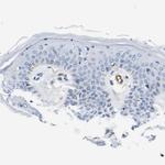 Dysferlin Antibody in Immunohistochemistry (Paraffin) (IHC (P))